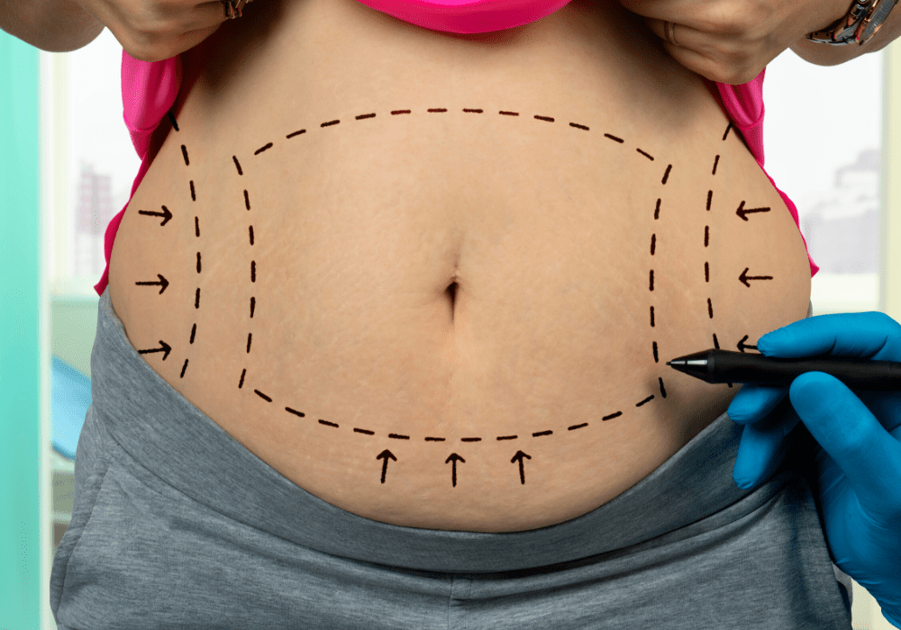 melanotan 2 tan Melanotan II (Tan Jabs): Why They're Not Worth The Risk